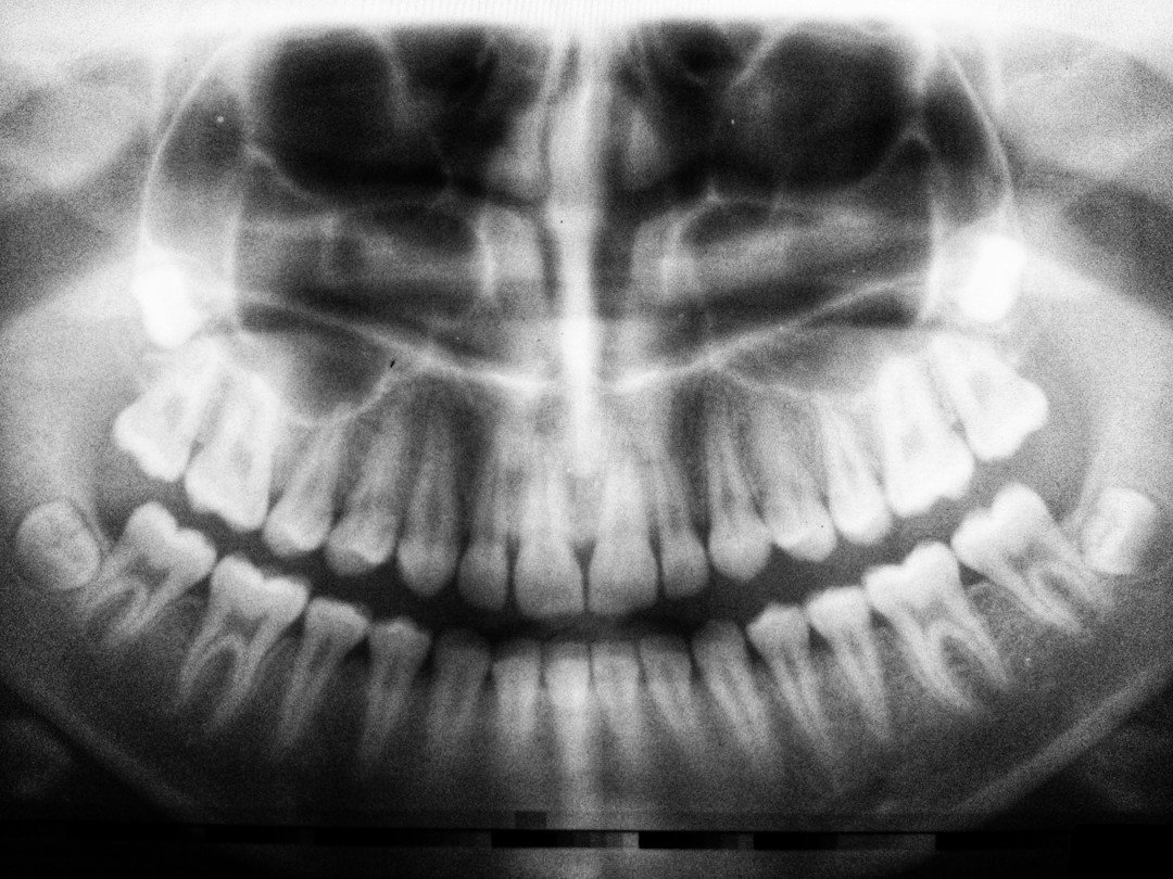Radiation quality control UAE for dental panoramic X-ray and dental imaging equipment
