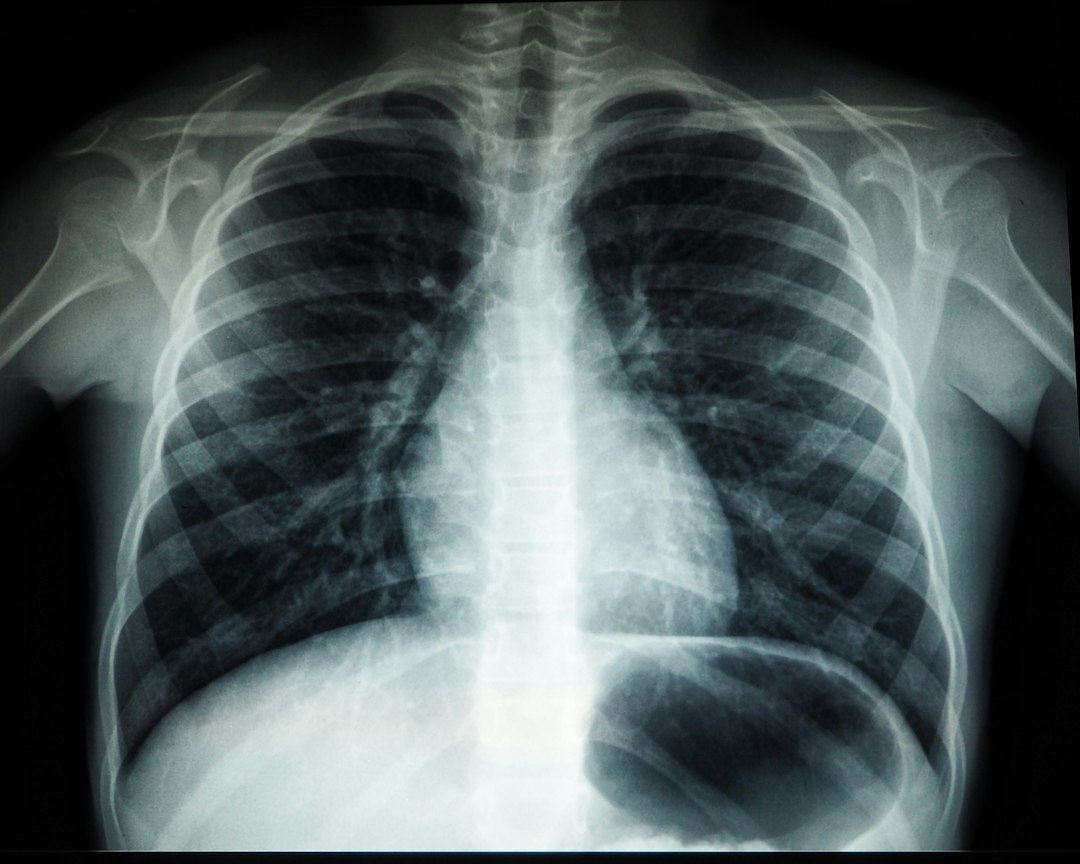Chest X-ray image used in diagnostic radiology